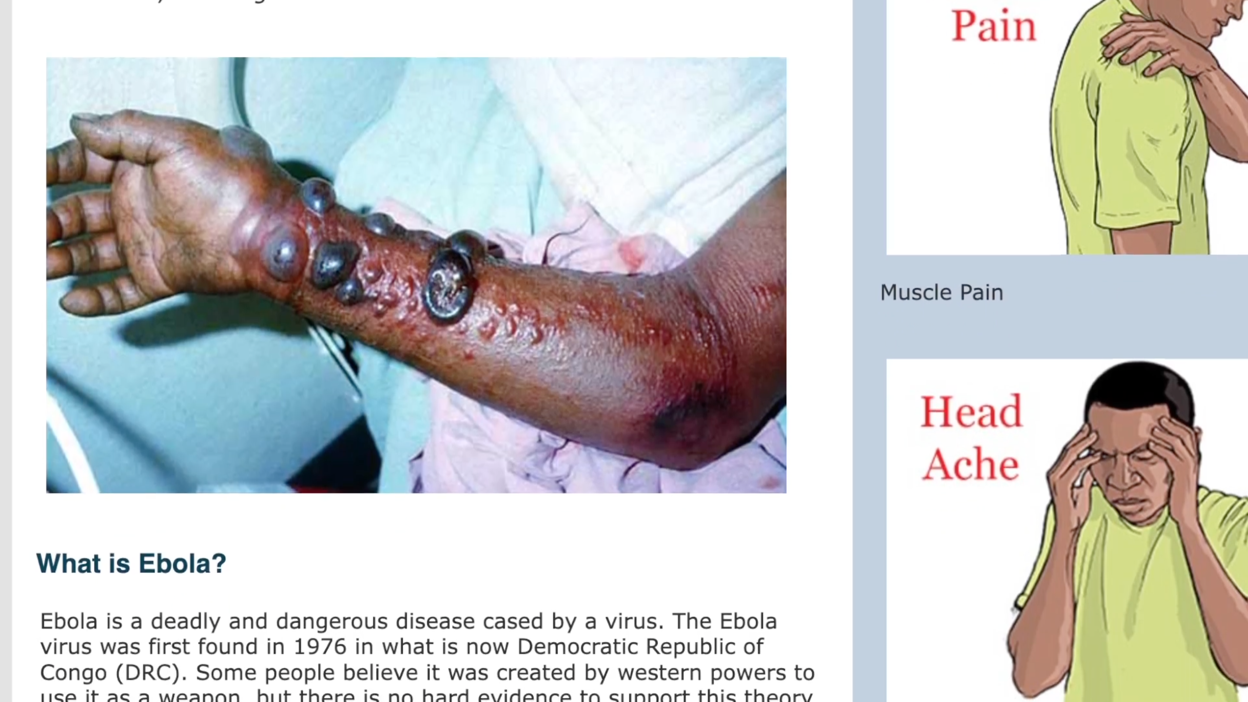 skin lesions caused by ebola