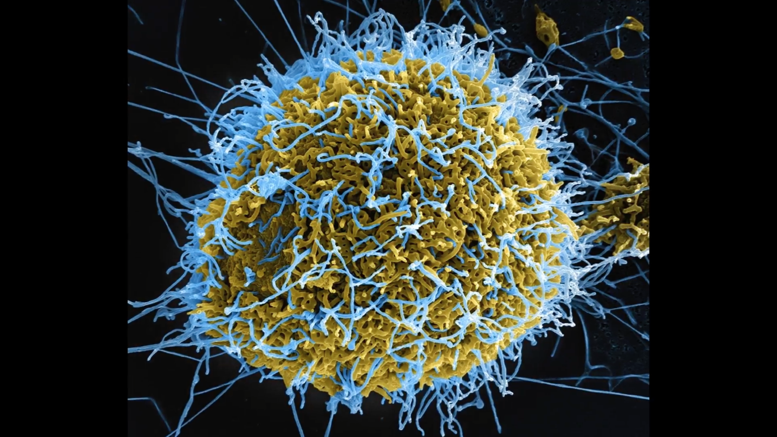ebola virus under a microscope