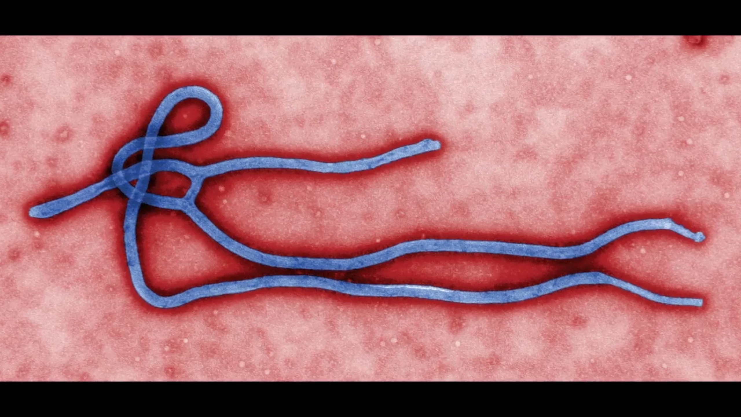 single strand of the ebola virus